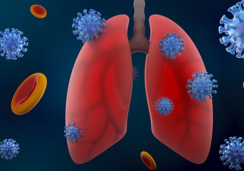 covid-19 attacking lungs
